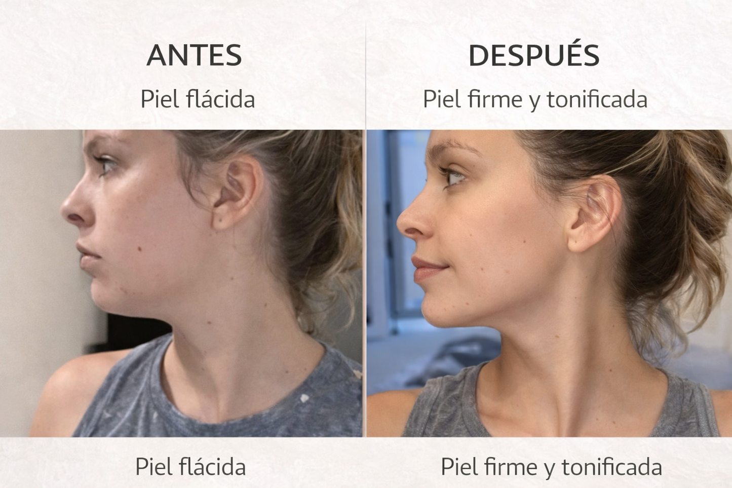 🔥 Recupera un rostro firme y juvenil desde casa en solo 5 minutos al día.🔥 Promoción válida solo hoy: 50% OFF